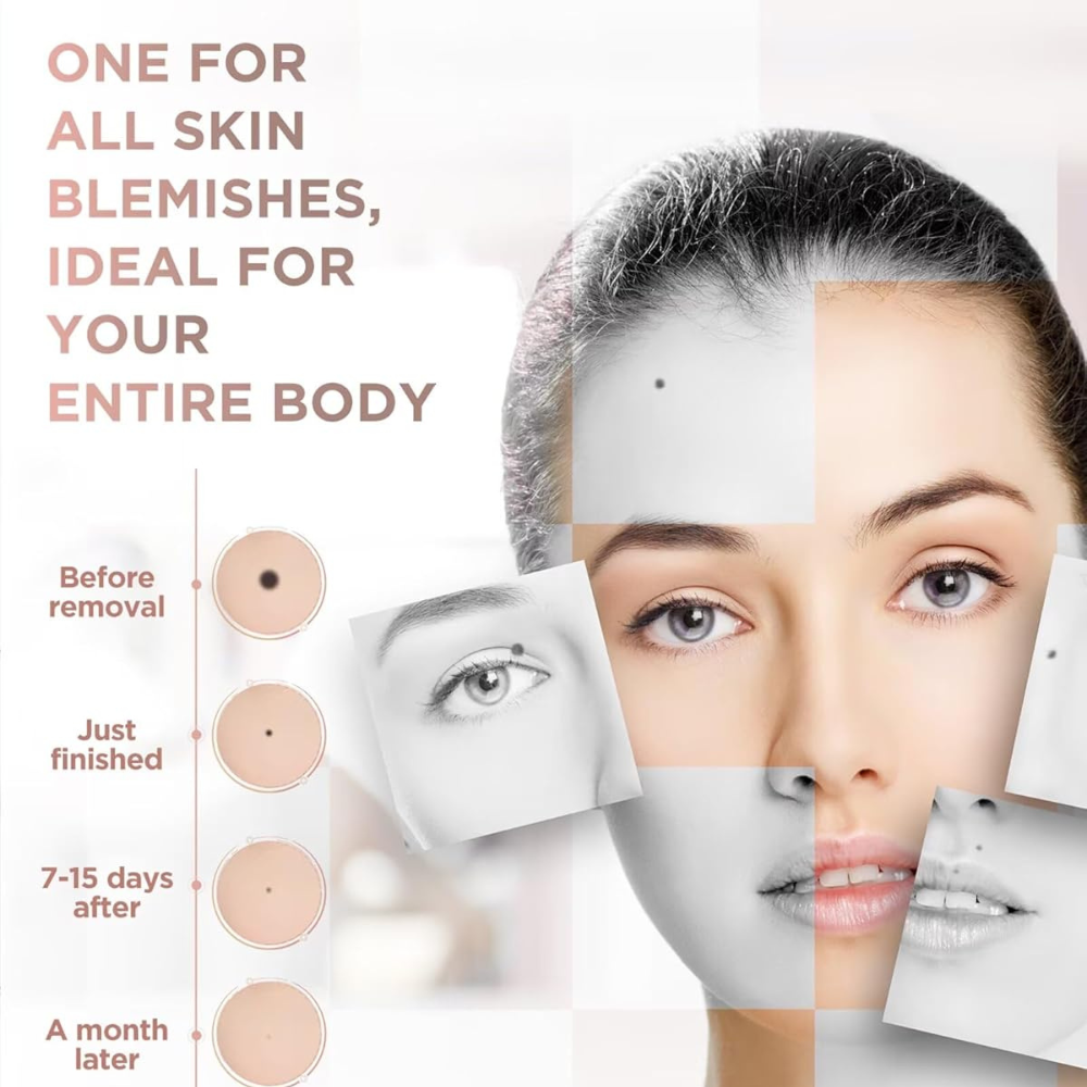 Bloomias Beauty Plasma Pen
